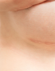 Cosmetic Procedures