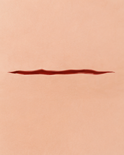 New Scar