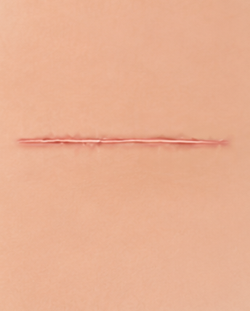 Old Scar